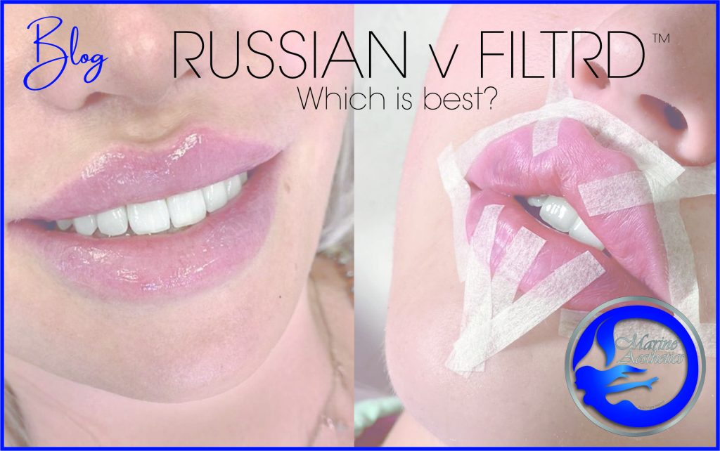 Russian Lips Versus Filtrd Lips Which Is Best Marine Aesthetics